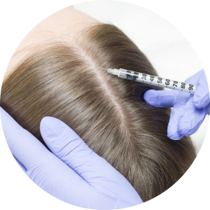 woman-receiving-injection-into-scalp-beauty-center-edited-2048x1151-photoaidcom-cropped